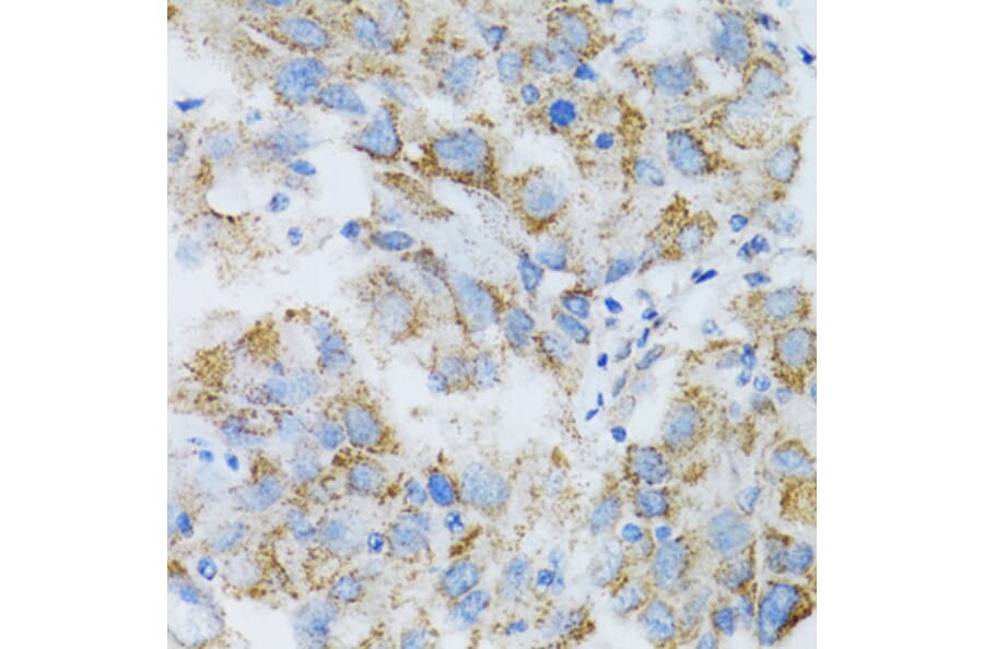 Immunohistochemistry - Anti-PSMD10 Antibody (A1949) - Antibodies.com