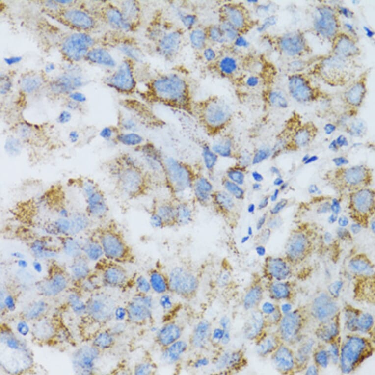 Immunohistochemistry - Anti-PSMD10 Antibody (A1949) - Antibodies.com