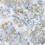 Immunohistochemistry - Anti-PSMD10 Antibody (A1949) - Antibodies.com