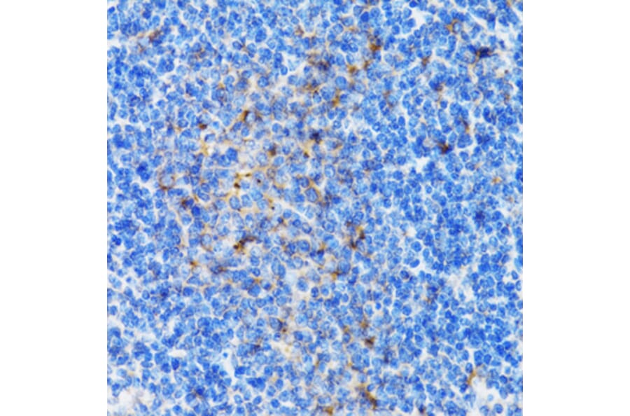 Immunohistochemistry - Anti-PSMD10 Antibody (A1949) - Antibodies.com