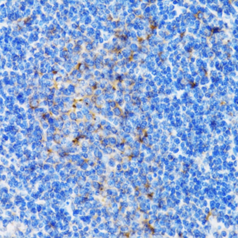 Immunohistochemistry - Anti-PSMD10 Antibody (A1949) - Antibodies.com