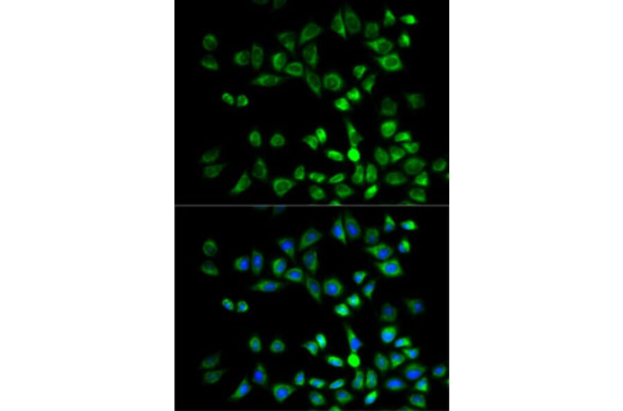 Immunofluorescence - Anti-PSMD10 Antibody (A1949) - Antibodies.com