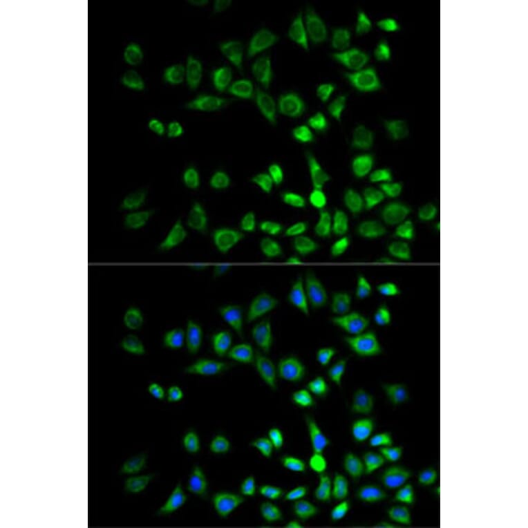 Immunofluorescence - Anti-PSMD10 Antibody (A1949) - Antibodies.com