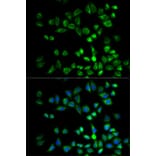 Immunofluorescence - Anti-PSMD10 Antibody (A1949) - Antibodies.com