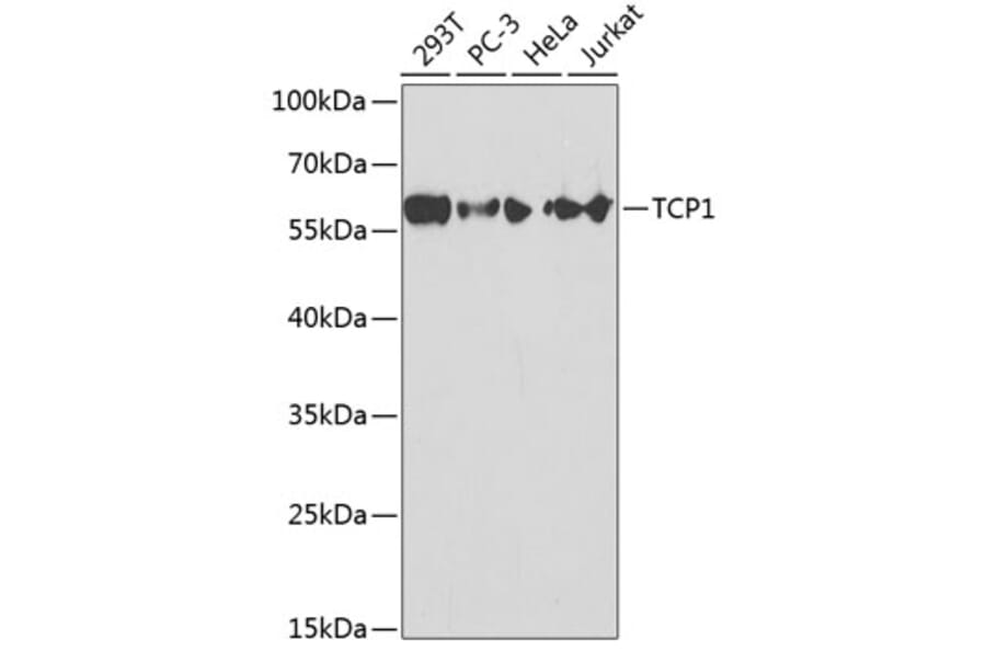 Western Blot - Anti-TCP1 alpha / CCTA Antibody (A13768) - Antibodies.com