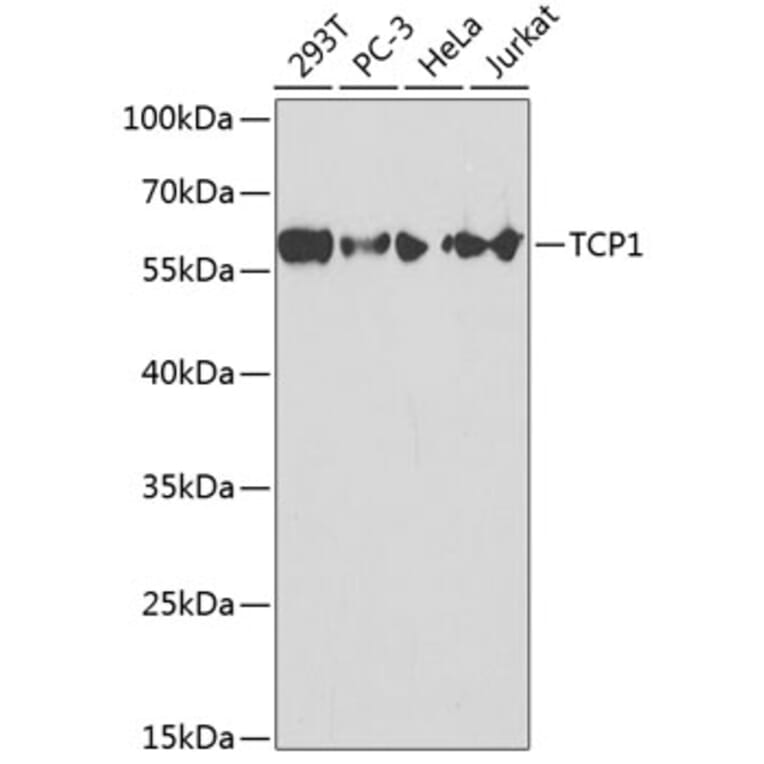 Western Blot - Anti-TCP1 alpha / CCTA Antibody (A13768) - Antibodies.com