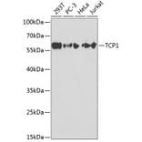 Western Blot - Anti-TCP1 alpha / CCTA Antibody (A13768) - Antibodies.com