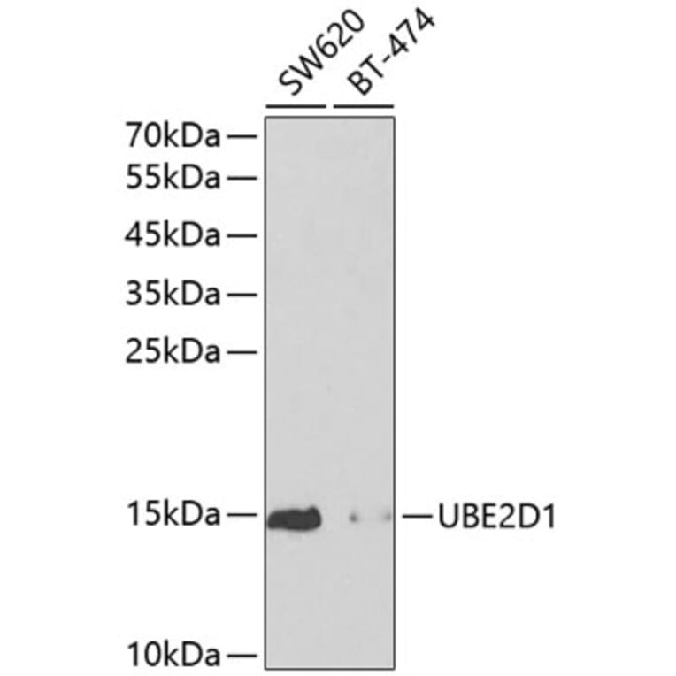 Western Blot - Anti-SFT Antibody (A13769) - Antibodies.com