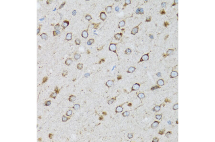 Immunohistochemistry - Anti-SFT Antibody (A13769) - Antibodies.com