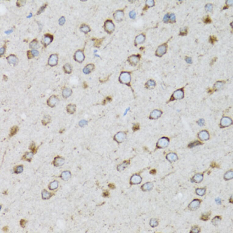 Immunohistochemistry - Anti-SFT Antibody (A13769) - Antibodies.com