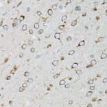 Immunohistochemistry - Anti-SFT Antibody (A13769) - Antibodies.com