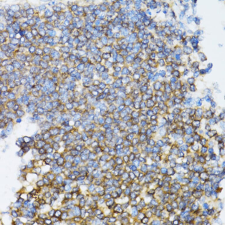 Immunohistochemistry - Anti-SFT Antibody (A13769) - Antibodies.com
