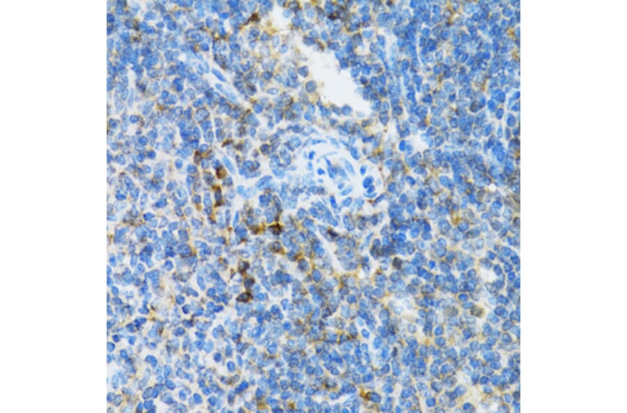 Immunohistochemistry - Anti-SFT Antibody (A13769) - Antibodies.com