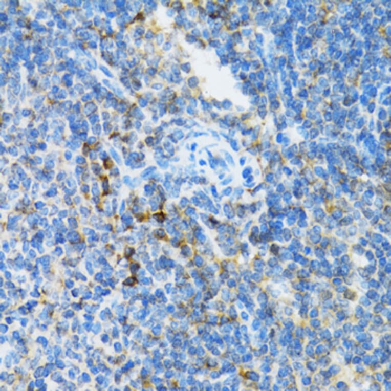 Immunohistochemistry - Anti-SFT Antibody (A13769) - Antibodies.com