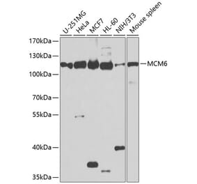 Western Blot - Anti-MCM6 Antibody (A13771) - Antibodies.com