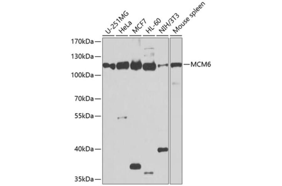 Western Blot - Anti-MCM6 Antibody (A13771) - Antibodies.com
