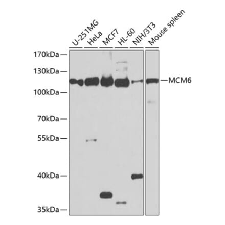 Western Blot - Anti-MCM6 Antibody (A13771) - Antibodies.com