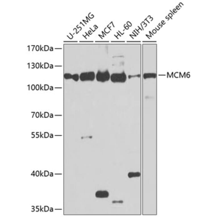 Western Blot - Anti-MCM6 Antibody (A13771) - Antibodies.com