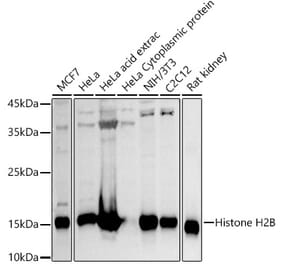 Western Blot - Anti-Histone H2B Antibody (A13773) - Antibodies.com