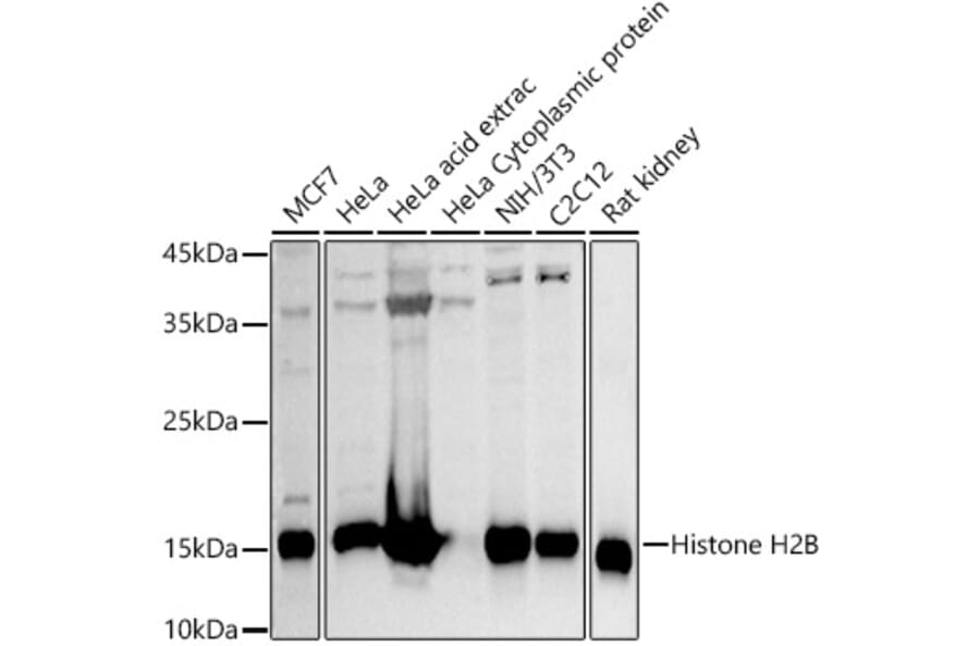 Western Blot - Anti-Histone H2B Antibody (A13773) - Antibodies.com