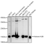 Western Blot - Anti-Histone H2B Antibody (A13773) - Antibodies.com