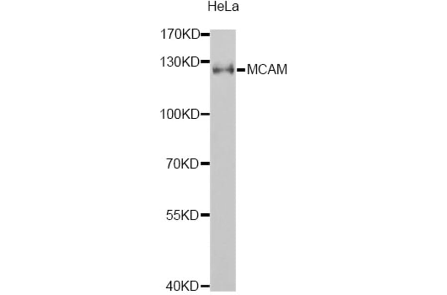 Western Blot - Anti-MCAM Antibody (A1962) - Antibodies.com