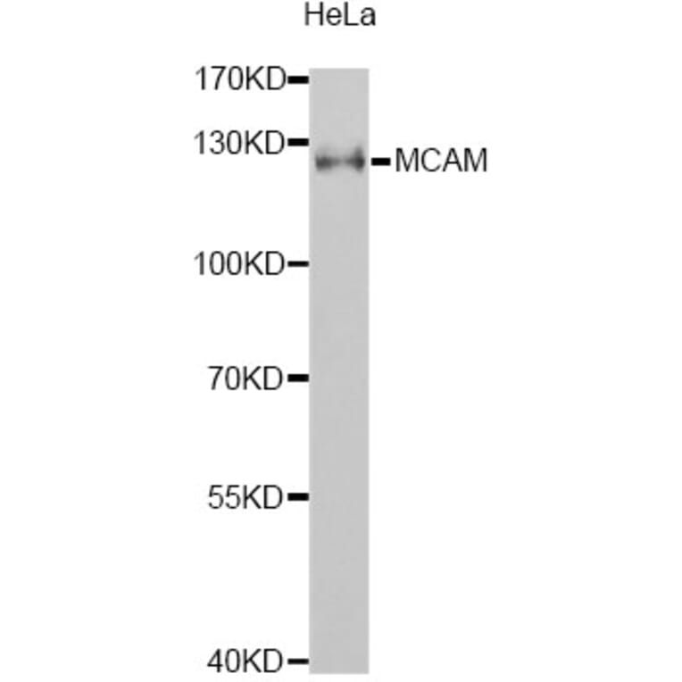 Western Blot - Anti-MCAM Antibody (A1962) - Antibodies.com