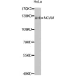 Western Blot - Anti-MCAM Antibody (A1962) - Antibodies.com