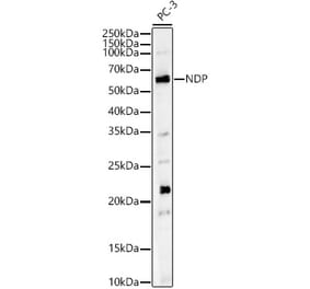 Western Blot - Anti-NDP Antibody (A13775) - Antibodies.com