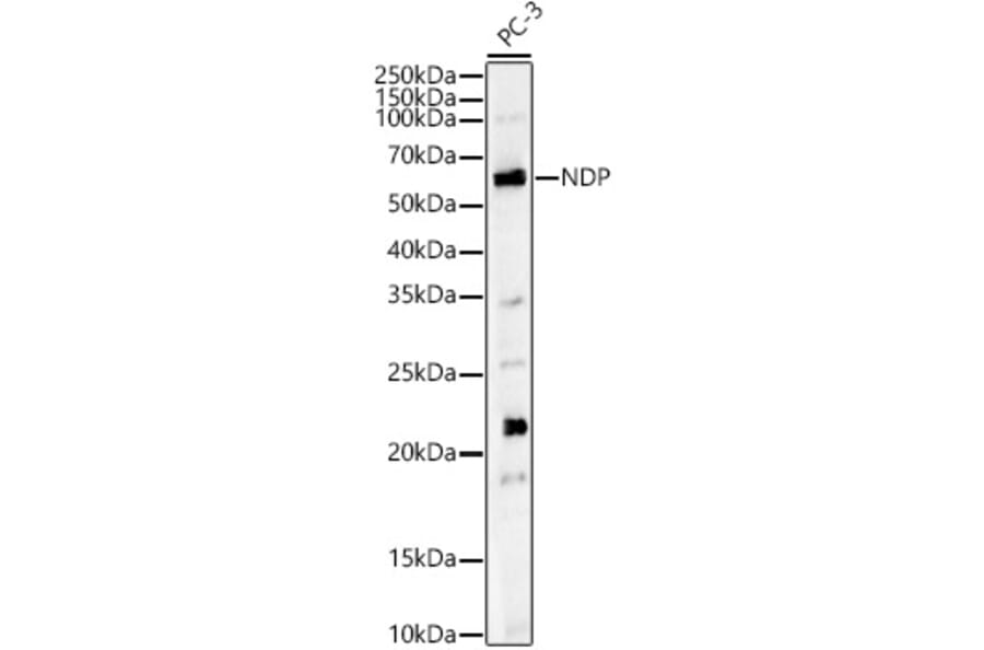 Western Blot - Anti-NDP Antibody (A13775) - Antibodies.com