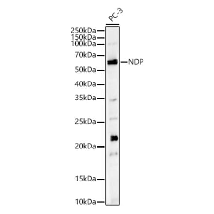 Western Blot - Anti-NDP Antibody (A13775) - Antibodies.com