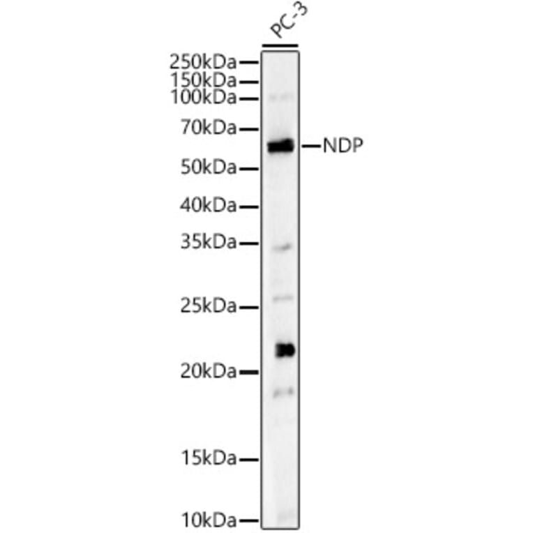 Western Blot - Anti-NDP Antibody (A13775) - Antibodies.com