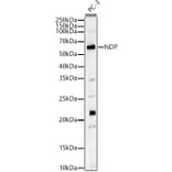 Western Blot - Anti-NDP Antibody (A13775) - Antibodies.com