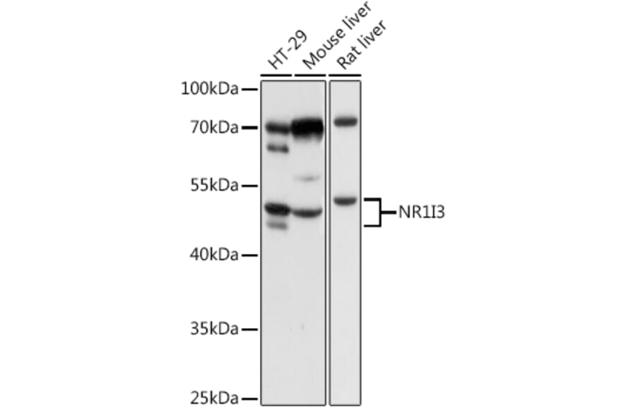 Western Blot - Anti-Constitutive androstane receptor Antibody (A13777) - Antibodies.com