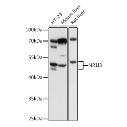 Western Blot - Anti-Constitutive androstane receptor Antibody (A13777) - Antibodies.com