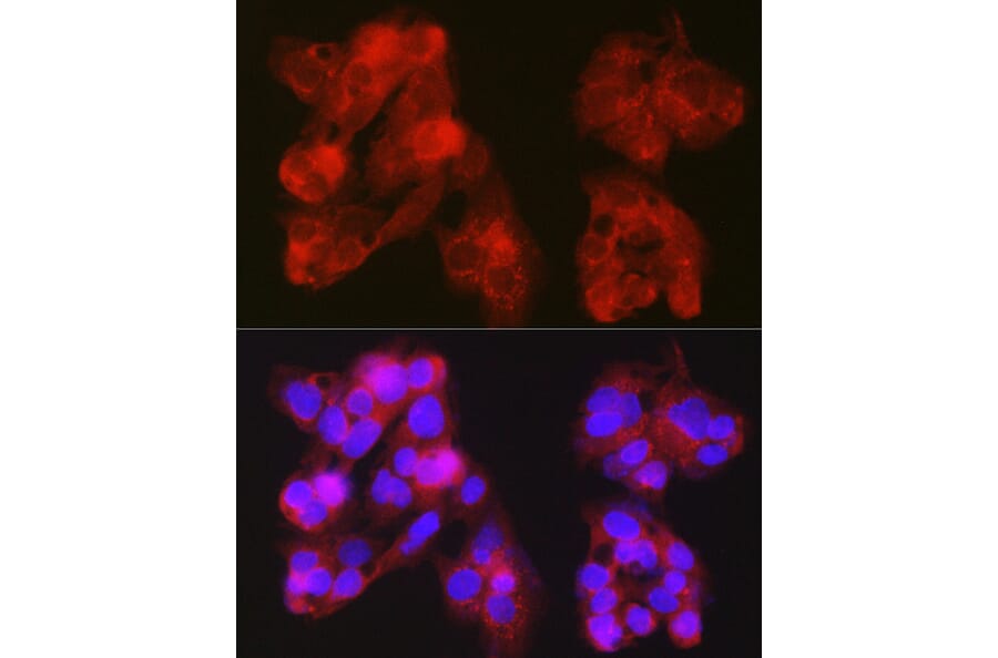 Immunofluorescence - Anti-Constitutive androstane receptor Antibody (A13777) - Antibodies.com