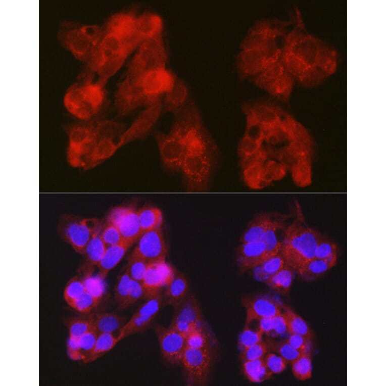 Immunofluorescence - Anti-Constitutive androstane receptor Antibody (A13777) - Antibodies.com