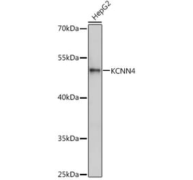 Western Blot - Anti-KCNN4 Antibody (A13780) - Antibodies.com