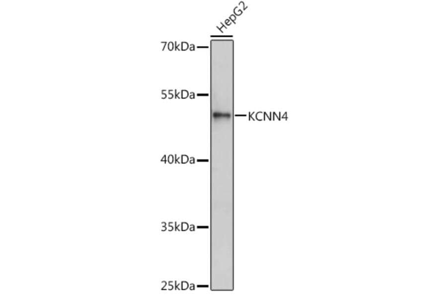 Western Blot - Anti-KCNN4 Antibody (A13780) - Antibodies.com