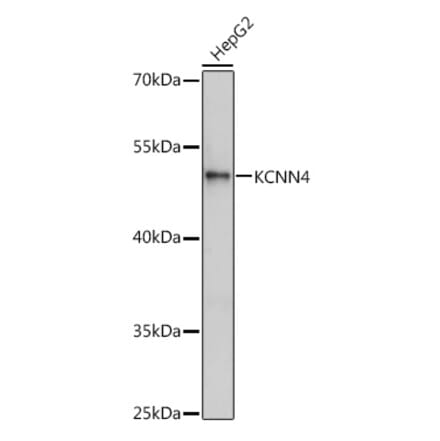 Western Blot - Anti-KCNN4 Antibody (A13780) - Antibodies.com