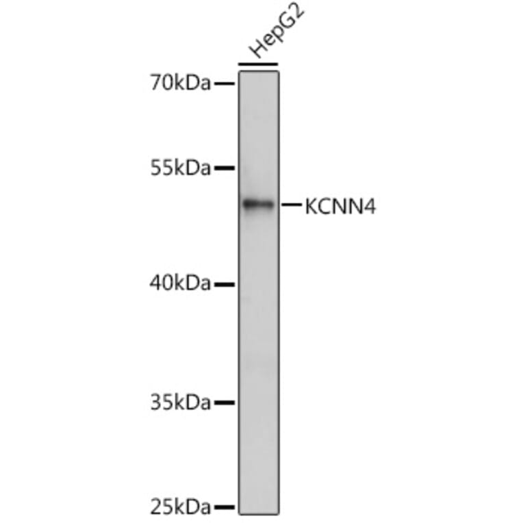 Western Blot - Anti-KCNN4 Antibody (A13780) - Antibodies.com