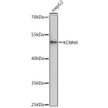 Western Blot - Anti-KCNN4 Antibody (A13780) - Antibodies.com