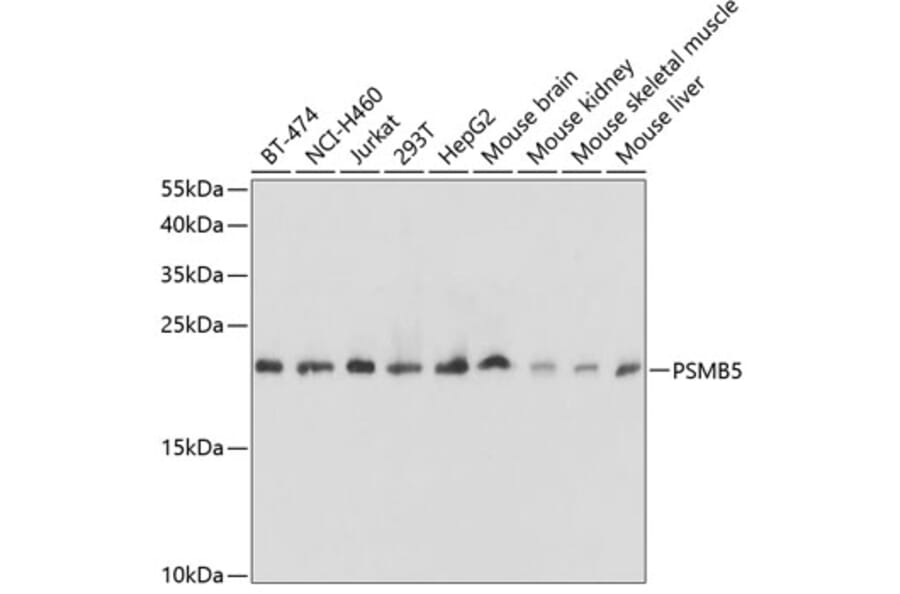 Western Blot - Anti-PSMB5/MB1 Antibody (A13781) - Antibodies.com