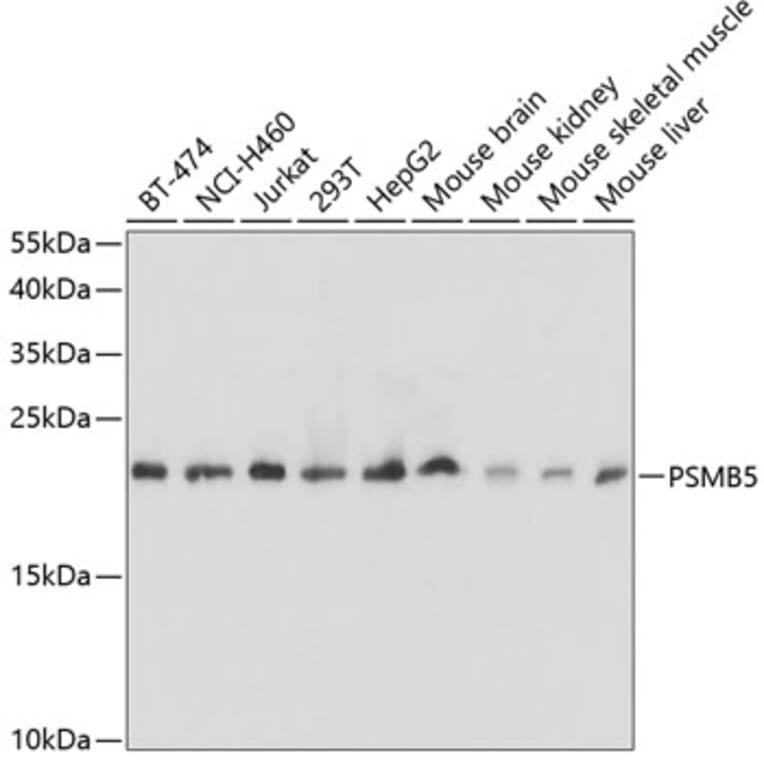 Western Blot - Anti-PSMB5/MB1 Antibody (A13781) - Antibodies.com