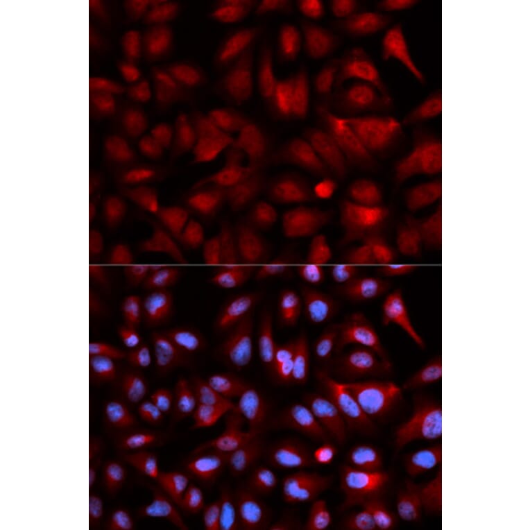 Immunofluorescence - Anti-PSMB5/MB1 Antibody (A13781) - Antibodies.com