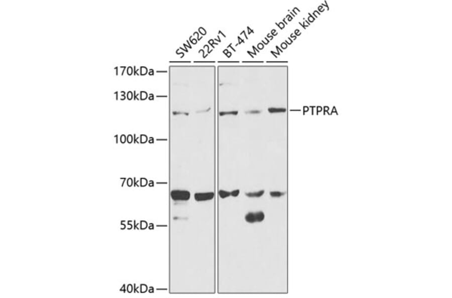 Western Blot - Anti-PTP alpha Antibody (A13782) - Antibodies.com