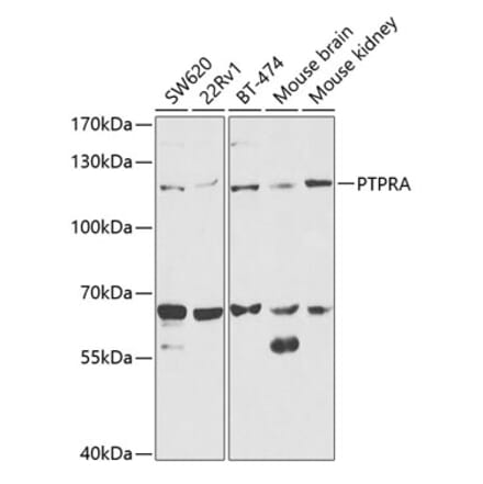 Western Blot - Anti-PTP alpha Antibody (A13782) - Antibodies.com