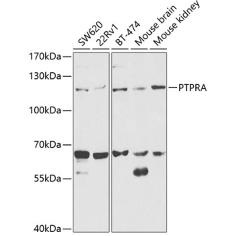 Western Blot - Anti-PTP alpha Antibody (A13782) - Antibodies.com