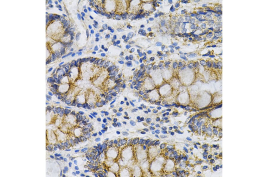Immunohistochemistry - Anti-PTP alpha Antibody (A13782) - Antibodies.com