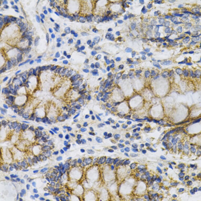 Immunohistochemistry - Anti-PTP alpha Antibody (A13782) - Antibodies.com